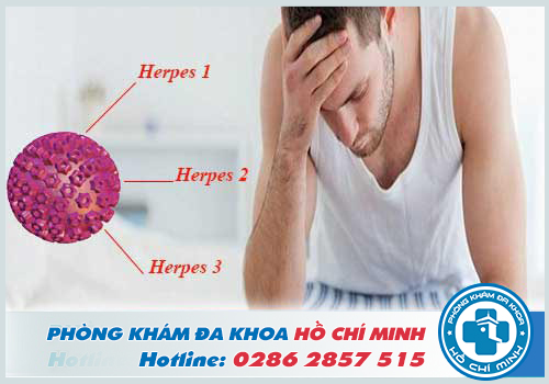 Bệnh mụn rộp sinh dục do virus Herpes Simplex gây ra