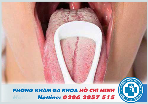 Khám lưỡi ở bệnh viện TPHCM tốt nhất giúp đem đến kết quả chính xác