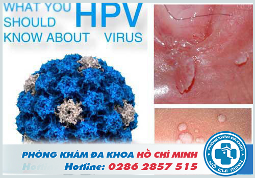 HPV mẫu vi rút dẫn tới bệnh mồng gà